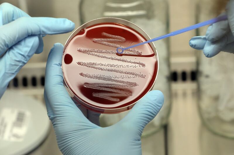 A strain of strep bacteria in a lab. Getty