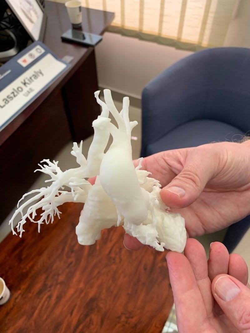 Doctors used a 3D printed model of Adam's heart to plan his 11-hour surgery. Courtesy: Sheikh Khalifa Medical City