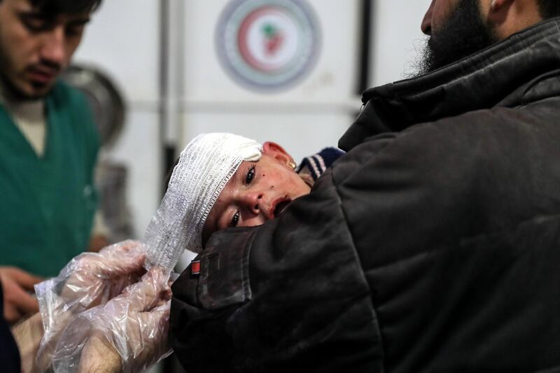 epa06352583 An injured nine-month old girls receives medical attention at the field hospital after bombings, rebel-held Douma, Syria, 26 November 2017. At least 25 were killed from bombings by forces allegedly loyal to the Syrian regime on Eastern al-Ghouta towns of Douma, Madera, and Mesraba.  EPA/MOHAMMED BADRA