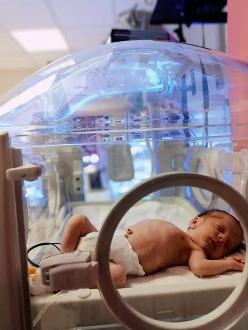 A baby in a neonatal ventilator at Khalil Suleiman Hospital in Jenin. Courtesy: Khalil Suleiman Hospital