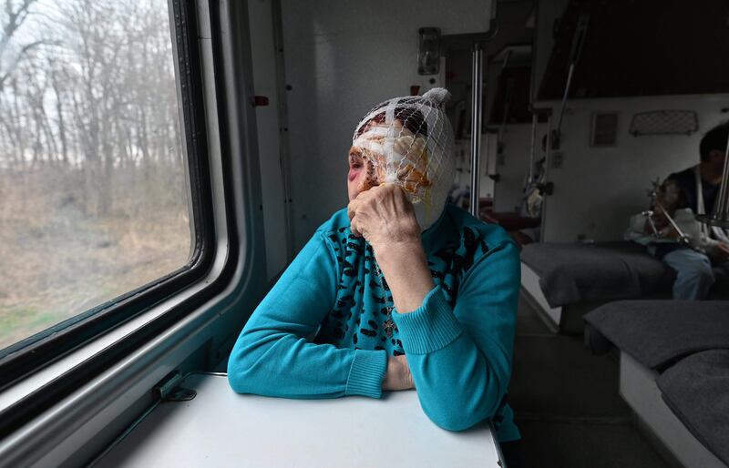 An injured Ukrainian on a medical evacuation train bound for the western Ukrainian city of Lviv. AFP