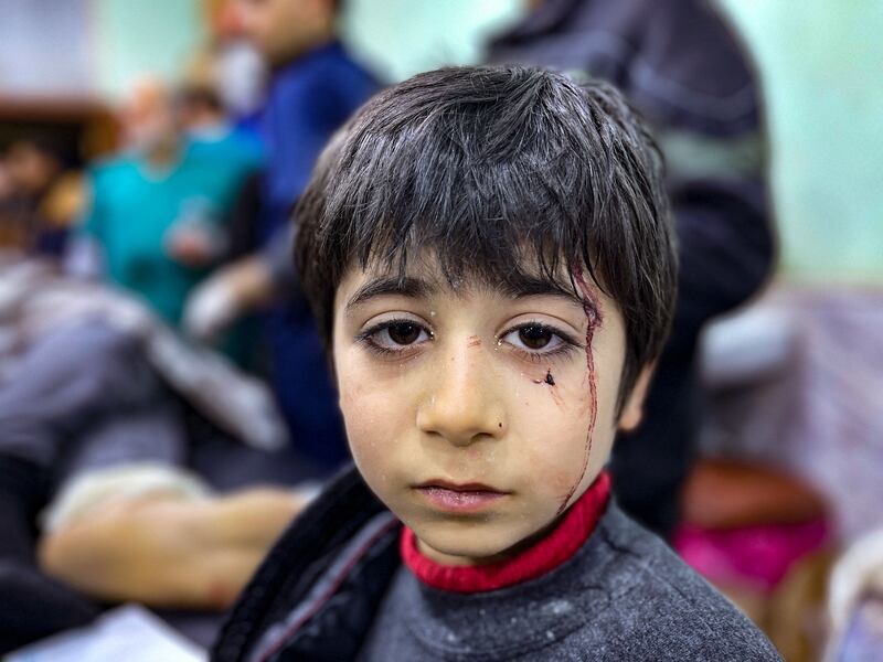 An injured child awaits treatment at Bab Al Hawa hospital. AFP