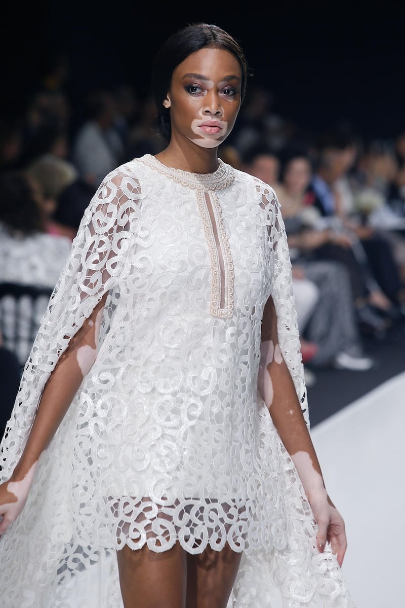 PARIS, FRANCE - JULY 03: Model Winnie Harlow walks the runway during the Sebastian Gunawan Couturissimo Fall/Winter 2016-2017 show as part of Paris Fashion Week on July 3, 2016 in Paris, France.  (Photo by Laurent Viteur/Getty Images) *** Local Caption ***  al15ma-fashion-afw01.jpg