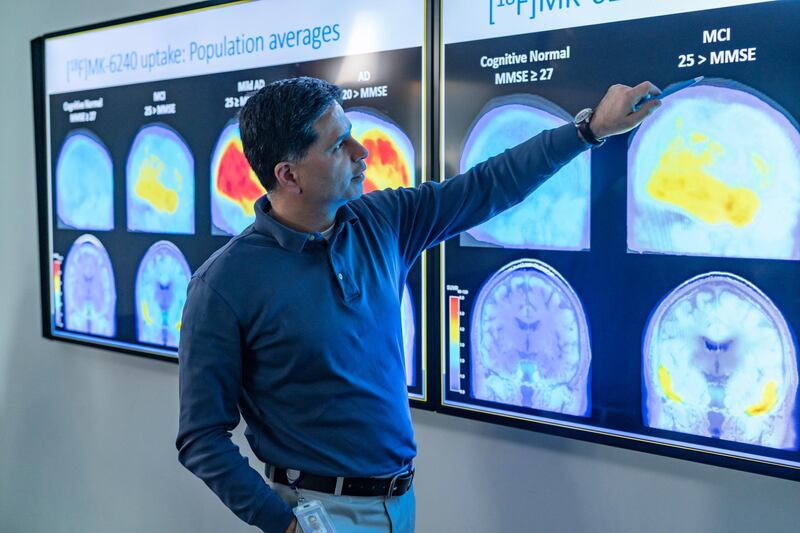 The US Food and Drug Administration has issued an accelerated approval for the experimental drug Aduhelm for use in patients with early onset Alzheimer's disease.  EPA /DAVID A. WHITE