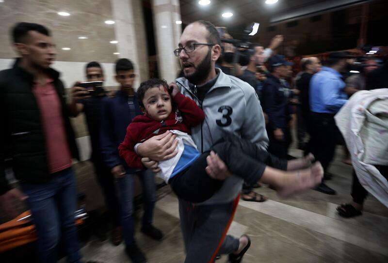 A wounded Palestinian child is carried into Nasser Hospital following an Israeli bombardment on Khan Younis refugee camp, southern Gaza Strip. AP