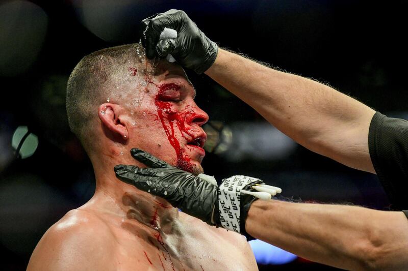 Nate Diaz has blood washed off his face during his UFC 244 bout against Jorge Masvidal. AFP