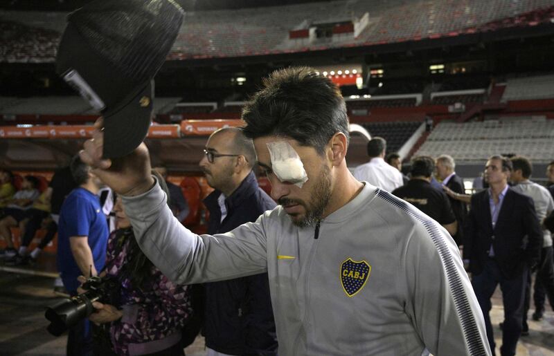 Boca Juniors' Pablo Perez is seen on the field of the Monumental stadium in Buenos Aires with an eye covered after authorities postponed the match. AFP