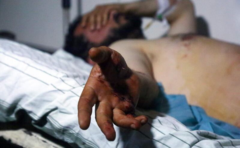 An injured man lies on a bed in a hospital in Syria’s northeastern city of Hassakeh on May 2, 2017, following an ISIL attack on a camp for displaced people near the country's border with Iraq. Delil Souleiman / AFP

