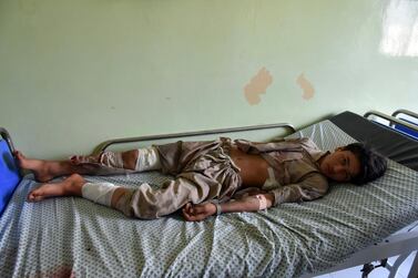An Afghan boy is treated in hospital after a Taliban attack in Aybak, the capital of the Samangan province, on July 13, 2020. AP Photo