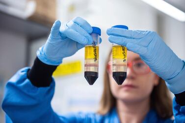 A researcher in a laboratory at the Jenner Institute in Oxford, England, works on the coronavirus vaccine developed by AstraZeneca and Oxford University. AP