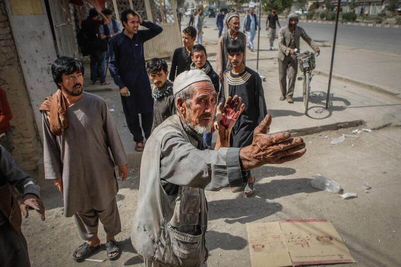 epa07760002 A man who was injured in a car bomb blast talks to people at the scene, in Kabul, Afghanistan, 07 August 2019. Dozens of people were injured when a car bomb exploded outside a police station in Kabul.  EPA/HEDAYATULLAH AMID