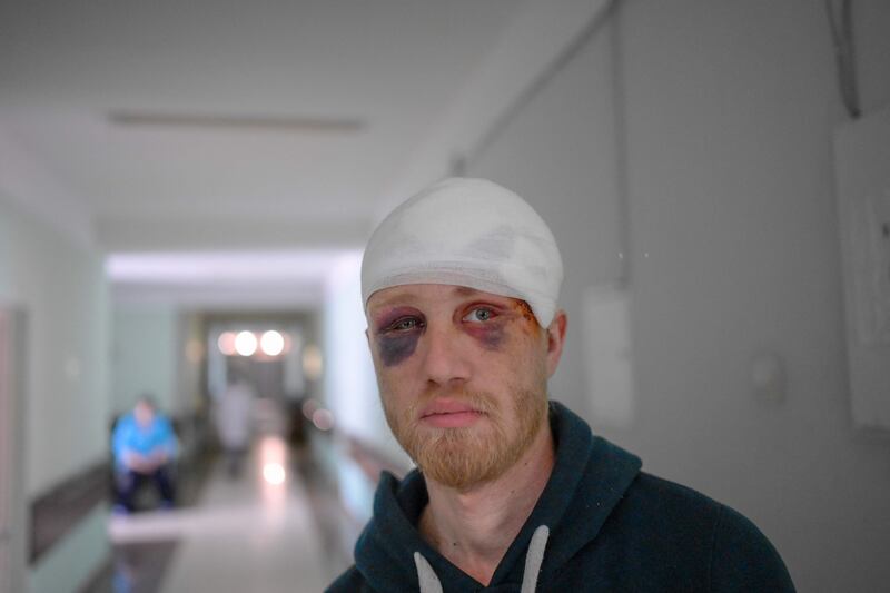 A wounded Ukrainian man waits in the corridor of the central hospital of Mykolaiv. AFP