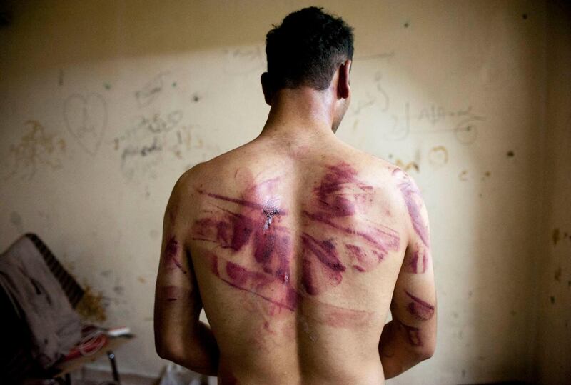 (FILES) In this file photo taken on August 23, 2012, a Syrian man shows marks of torture on his back, after he was released by regime forces, in the Bustan Pasha neighbourhood of Syria's northern city of Aleppo.  / AFP / JAMES LAWLER DUGGAN
