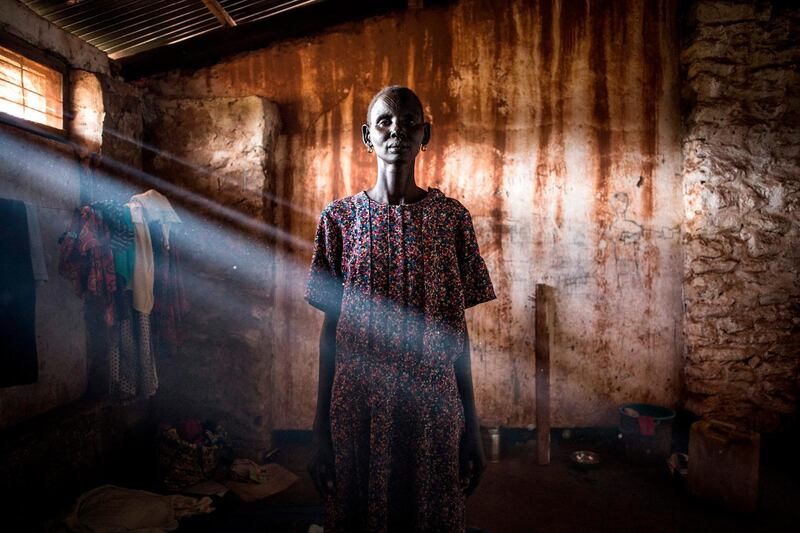 Elizabeth, a South Sudanese refugee, poses inside a transition camp in Aru in the Democratic Republic of the Congo.  AFP