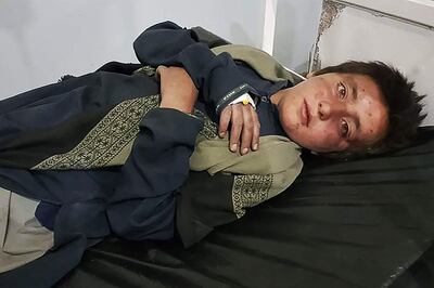 A boy receives treatment at a hospital in Afghanistan's Khost province after air strikes allegedly carried out by Pakistan's military. A local Taliban leader said as many 36 people were killed. AFP