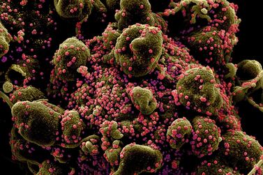 A micrograph of a cell (in green) heavily infected with Sars-CoV-2 virus particles, rendered in pink, isolated from a patient sample. Reuters