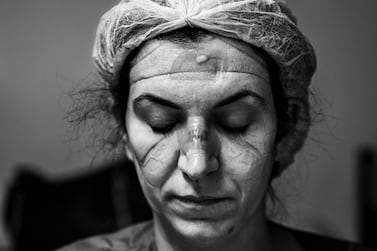 Brazilian photographer Ary Bassous’ photo of Dr Juliana Ribeiro after eight hours of continuous work in the Covid-19 emergency room has won him the grand prize at the 10th season of HIPA.