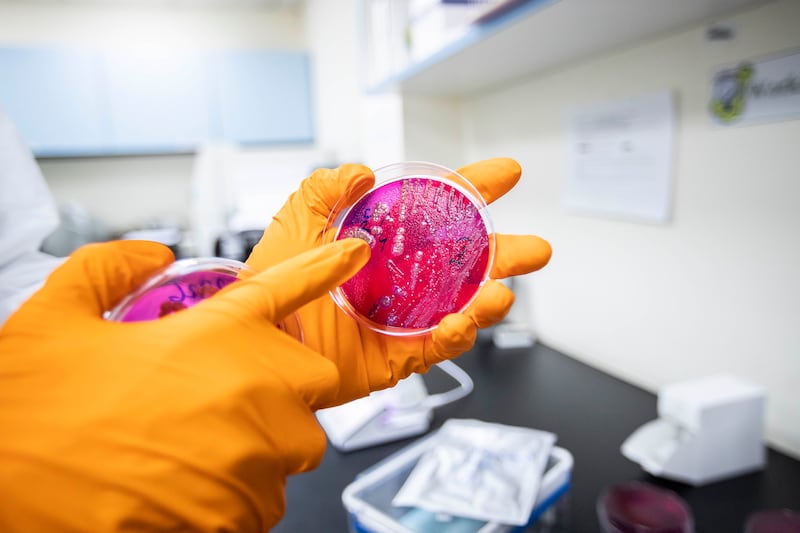 A laboratory technician at the Abu Dhabi Quality and Conformity Council shows cultures growing in a petri dish.