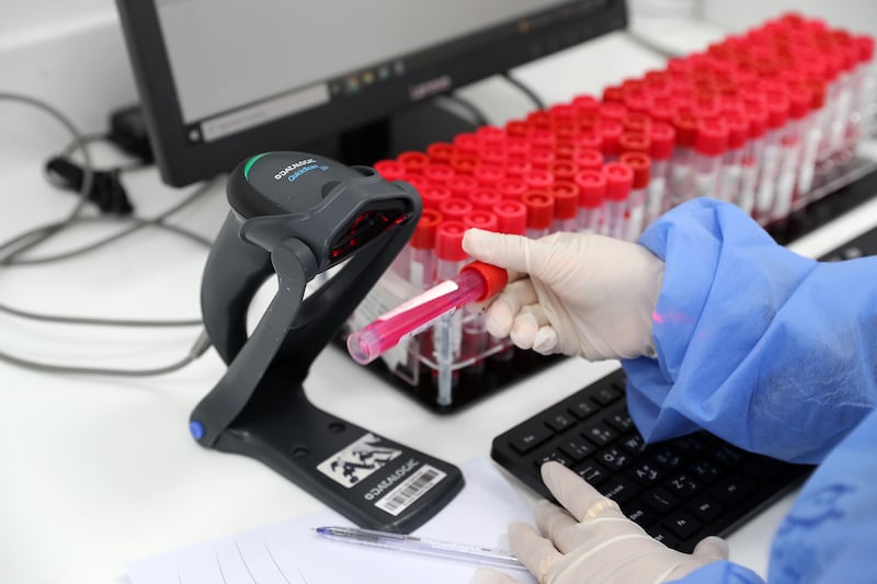 Lab staff scanning the barcode of a Covid-19 PCR sample.