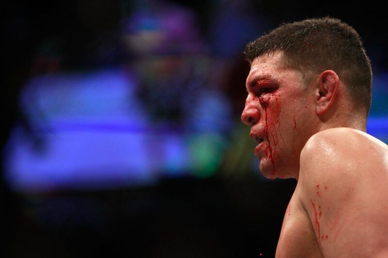 Nick Diaz shown bloodied in the Octagon after taking a hit from Anderson Silva during their middleweight fight at UFC 183 on Saturday. Steve Marcus / Getty Images / AFP