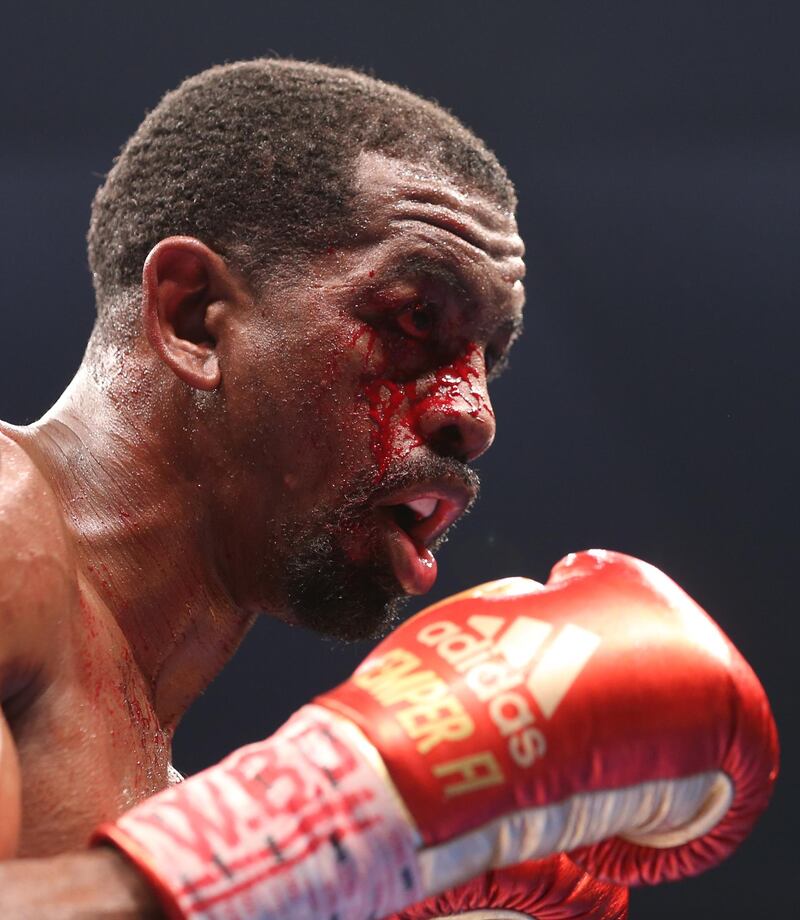 Jamel Herring has blood on his face following a clash of heads.