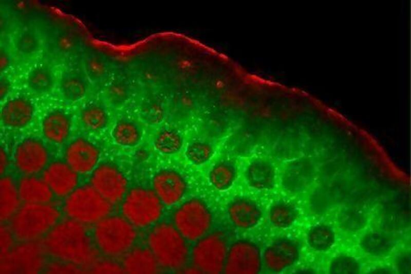 A microscopic image shows a Porites coral from Abu Dhabi. Scientists believe its fluorescent pigments may play a role in protecting it from harsh temperatures.