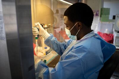 A laboratory technician processes samples for testing the COVID-19, novel coronavirus, at the Rwanda Biomedical Center (RBC), which is conducting nation-wide mass testing with around 2000 to 5000 tests per day being analysed, in Kigali on July 11, 2020. (Photo by Simon Wohlfahrt / AFP)