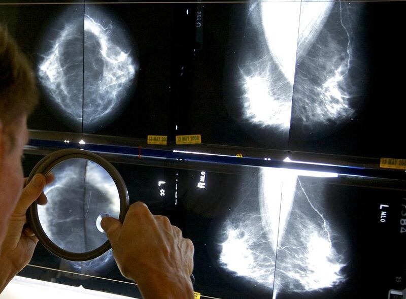 A radiologist uses a magnifying glass to check mammograms for breast cancer. Damian Dovarganes / AP