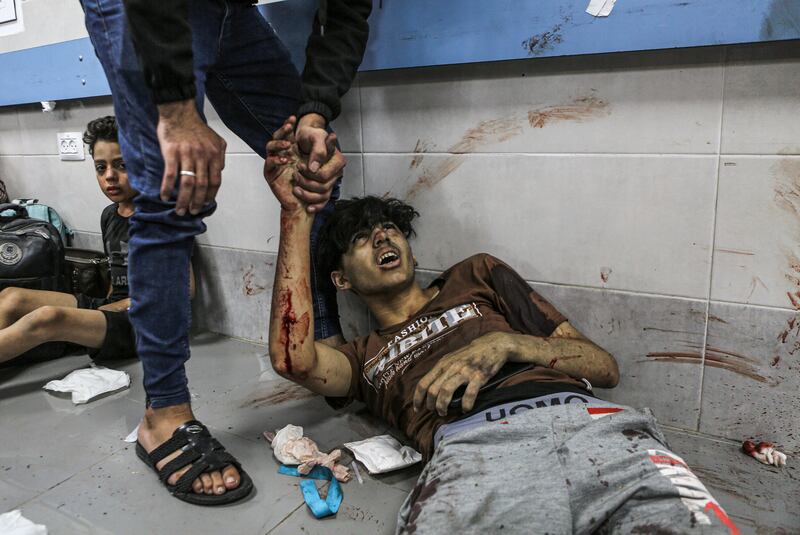 Wounded Palestinians lie on the floor in Al-Shifa Hospital in Gaza city after arriving from al-Ahli Hospital following an explosion there. AP