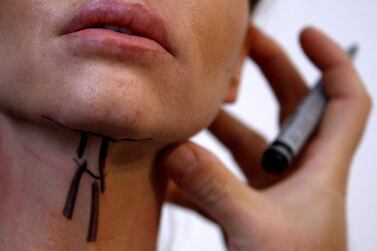 UAE medics are concerned about 'Botox parties' run by unlicensed practitioners. Bernadett Szabo / Reuters