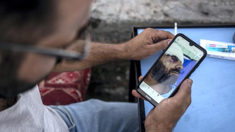 Haider Hasan Alwan looking at a photo on his phone showing his injury. Haider Husseini for The National