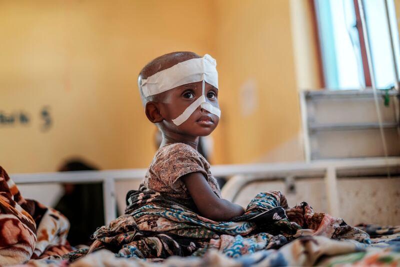 The last famine was declared in Somalia in 2011, when 260,000 people - half of them children under the age of six - died of hunger, partly because the international community did not act fast enough, says the UN