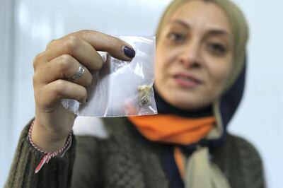 A Scientist displays a 2000 years-old teath which she is making researches on at the International Research Centre SESAME ( Synchrotron-light for Experimental Science and Applications in the Middle East) near Amman, Jordan. ( Salah Malkawi for The National)