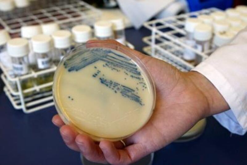 **ADVANCE FOR THURSDAY, DEC. 31** This Oct. 12, 2009 photo shows a petri dish with methicillin-resistant Staphylococcus aureus (MSRA) cultures at the Queen Elizabeth Hospital in King's Lynn, England. (AP Photo/Kirsty Wigglesworth)