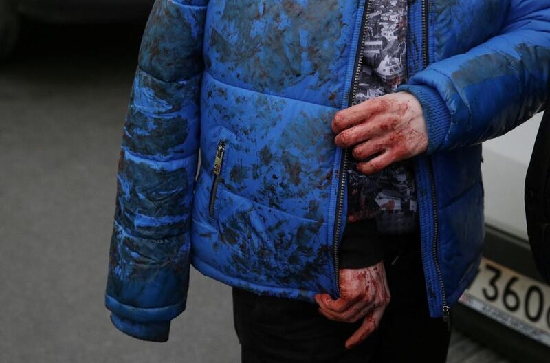 An injured person walks outside Sennaya Ploshchad metro station, following the explosion. Anton Vaganov / Reuters