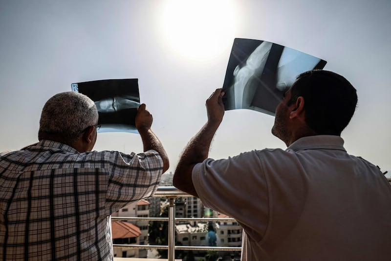 Men use X-ray images as filters to view a partial solar eclipse visible from Gaza city. AFP
