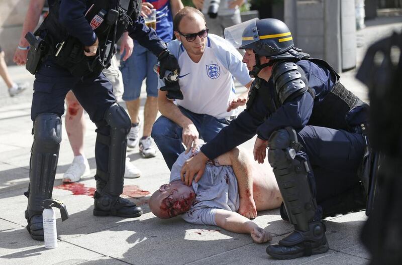 A man injured in clashes is assisted by police officers in downtown Marseille, France. Riot police have thrown tear gas canisters at soccer fans in Marseille’s Old Port in a third straight day of violence in the city. Darko Bandic / AP