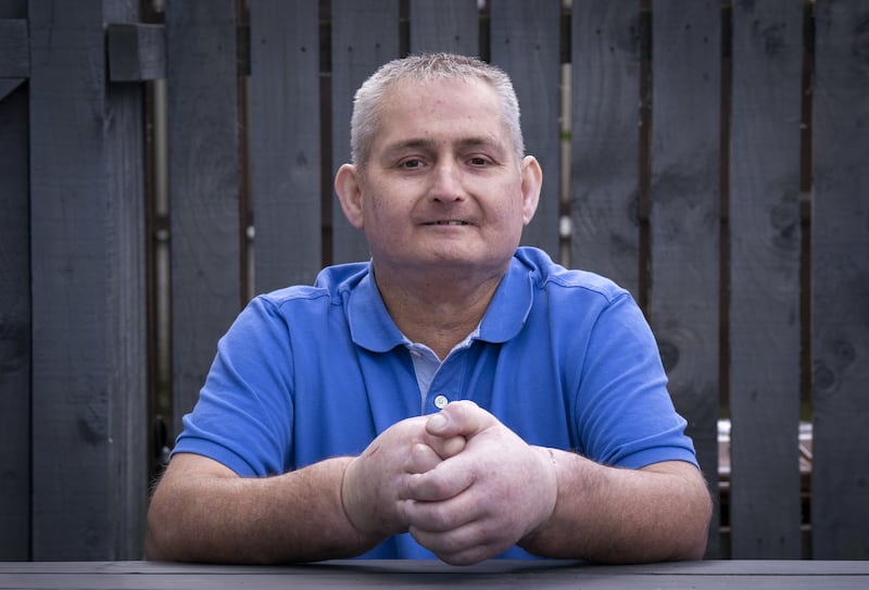 Steven Gallagher, from Dreghorn, Ayrshire, is the first person in the world to have a double hand transplant after suffering from the rare disease scleroderma. Picture date: Tuesday May 24, 2022.