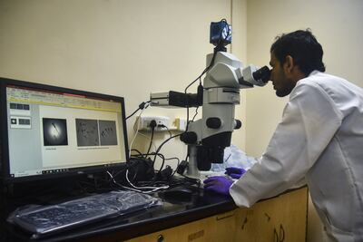 A researcher at work in a laboratory at the Indian Institute of Technology Chennai, developing a drug to treat a rare genetic disease. EPA