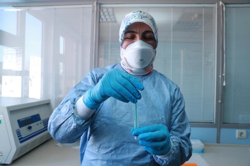 A Turkish Health Ministry employee displays materials for a rapid test kit for coronavirus at a laboratory in Ankara, Turkey. Reuters