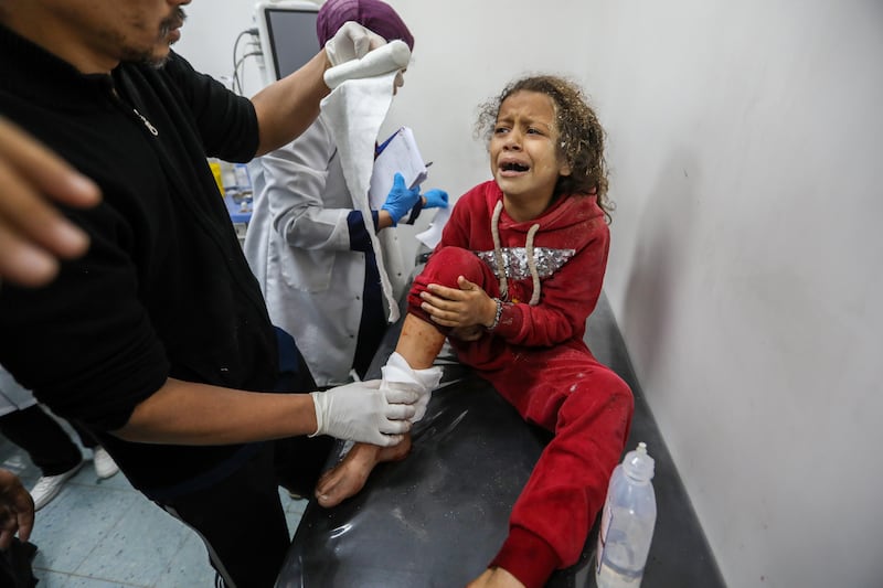A Palestinian child wounded in Israeli air strikes arrives at Kuwait Hospital for treatment last month in Rafah, Gaza. Getty Images