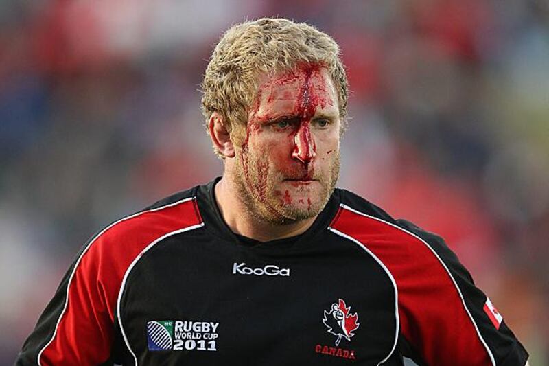 WHANGAREI, NEW ZEALAND - SEPTEMBER 14:  Pat Riordan of Canada bleeds during the IRB 2011 Rugby World Cup Pool A match between Tonga and Canada at Northland Events Centre on September 14, 2011 in Whangarei, New Zealand.  (Photo by Hannah Johnston/Getty Images)
