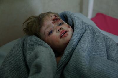 A Syrian child who was injured in shelling on the town of Misraba receives treatment at a make-shift hospital in the besieged rebel-held town of Douma, on the outskirts of the capital Damascus on early January 4, 2018.
At least 23 civilians were killed in the Syrian opposition redoubt of East Ghouta, near Damascus, with the majority of victims perishing in Russian air raids, a monitor said.  / AFP PHOTO / HASAN MOHAMED