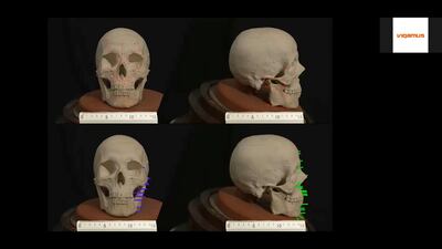 In this still image taken from a video an animation shows a three-dimensional computer reconstruction of face of Renaissance master Raphael from a plaster cast of his skull, in Rome, Italy August 6, 2020. Picture taken August 6, 2020. TOR VERGATA UNIVERSITY AND FONDAZIONE VIGAMUS/Handout via REUTERS ATTENTION EDITORS - THIS IMAGE HAS BEEN SUPPLIED BY A THIRD PARTY.