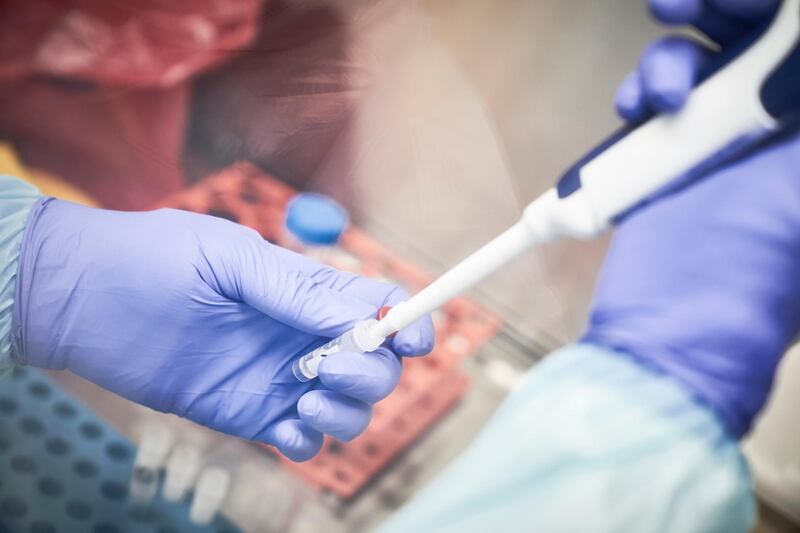 A Malian researcher conducts a COVID-19 coronavirus test, in the laboratory of the "Point G" hospital in Bamako, on March 19, 2020. Although no positive cases have yet been confirmed in Mali, hospitals and doctors are getting ready for a potential emergency.
 / AFP / MICHELE CATTANI
