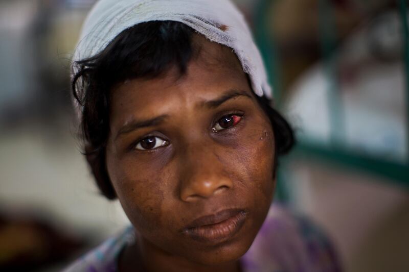 Rohingya woman Dildar Begum gets treatment at Sadar Hospital in Cox's Bazar, Bangladesh. Bernat Armangue / AP Photo