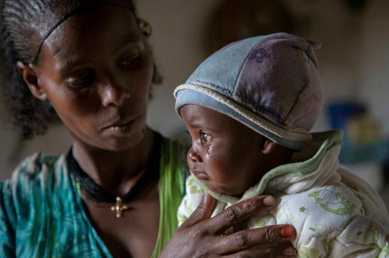 A mother comforts her baby, who was identified as severely acutely malnourished, in Gijet, southern Tigray. AP