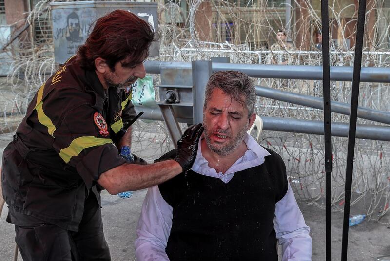 epa07949713 An injured protester received medical aid after a scuffle with Hezbollah supporters shouting pro-Hezbollah slogans, during a ninth day of anti-government protests in Beirut, Lebanon, 25 October 2019. Thousands took to the streets during a second weeek of protests against proposals of tax hikes and state corruption, and calling for the resignation of the government.  EPA/NABIL MOUNZER