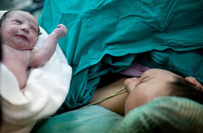 C-sections accounted for 72 per cent of births in Egypt in 2021. Getty Images
