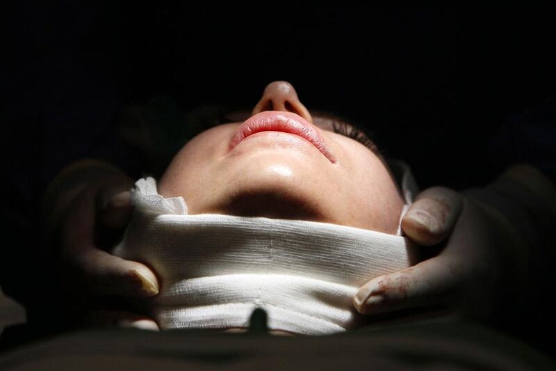 A woman lies on an operating table during a facelift surgery. (Bernadett Szabo / Reuters)
